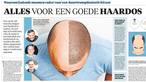 Redenen Voor Haartransplantatie: Waarom Mensen Kiezen Voor Deze Behandeling