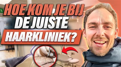 Hoe Te Kiezen Voor De Juiste Haartransplantatie Kliniek